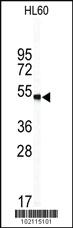 Anti-WISP1 Rabbit Polyclonal Antibody