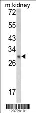 Anti-EBP Rabbit Polyclonal Antibody