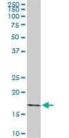 Anti-RHEB Mouse Monoclonal Antibody [clone: 2C11]