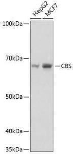 Anti-CBS antibody