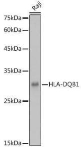 Anti-HLA-DQB1 Rabbit Polyclonal Antibody