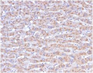 Anti-CD40L antibody