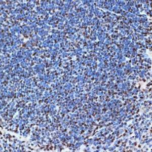 Immunohistochemistry analysis of paraffin-embedded mouse spleen using Anti-SET/TAF-I Antibody [ARC1462] (A305799) at a dilution of 1:100 (40X lens). Perform microwave antigen retrieval with 10 mM Tris/EDTA buffer pH 9.0 before commencing with IHC staining protocol