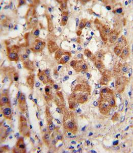 Anti-NAT2 Rabbit Polyclonal Antibody