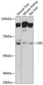 Anti-CBS antibody