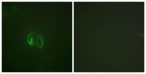 Immunofluorescence analysis of HepG2 cells using Anti-IL-10R alpha Antibody. The right hand panel represents a negative control, where the antibody was pre-incubated with the immunising peptide