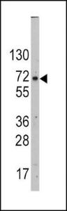 Anti-SLC2A2 Rabbit Polyclonal Antibody (Biotin)