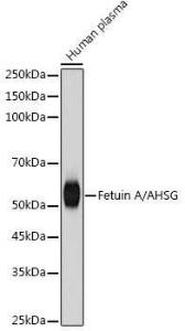 Anti-AHSG Rabbit Monoclonal Antibody [clone: ARC2433]