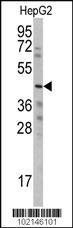 Anti-WISP3 Rabbit Polyclonal Antibody