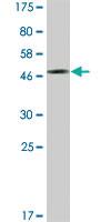 Anti-PDCL3 Mouse Monoclonal Antibody [clone: 1F10]