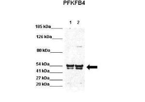 Anti-PFKFB4 Rabbit Polyclonal Antibody