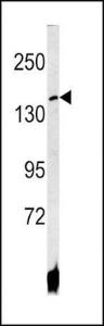 Anti-ATP7B Rabbit Polyclonal Antibody