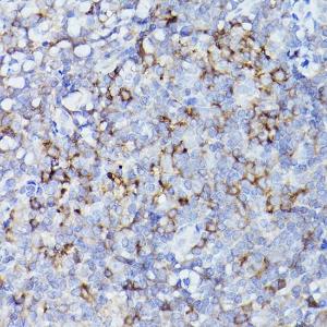 Anti-HLA-DQB1 Rabbit Polyclonal Antibody