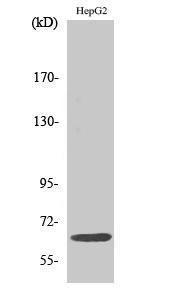 Western blot analysis of various cells using Anti-IL-10R alpha Antibody