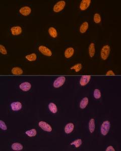 Immunofluorescence analysis of U-2 OS cells using Anti-SET/TAF-I Antibody [ARC1462] (A305799) at a dilution of 1:100 (40X lens). DAPI was used to stain the cell nuclei (blue)