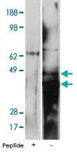 Anti-DEGS2 Rabbit Polyclonal Antibody