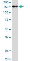 Anti-TCOF1 Rabbit Polyclonal Antibody