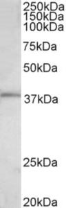 EB11742 (0.3 µg/ml) staining of HeLa lysate (35 µg protein in RIPA buffer). Primary incubation was 1 hour. Detected by chemiluminescence.