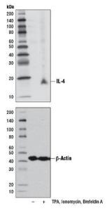 Anti-IL4 Rabbit Monoclonal Antibody [clone: 13G40]