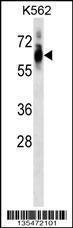 Anti-CDK8 Rabbit Polyclonal Antibody (PE (Phycoerythrin))