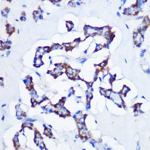 Anti-CBS antibody