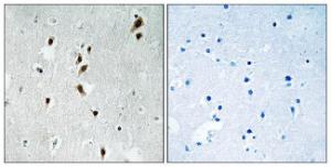 Immunohistochemical analysis of paraffin-embedded human brain using Anti-Mnk1 (phospho Thr385) Antibody. The right hand panel represents a negative control, where the antibody was pre-incubated with the immunising peptide.