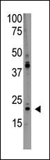 Anti-PDAP1 Rabbit Polyclonal Antibody