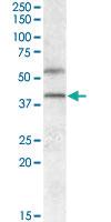 Anti-HCAR1 Goat Polyclonal Antibody