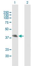 Anti-SFTPB Mouse Polyclonal Antibody