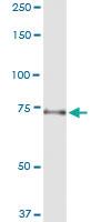 Anti-TUBGCP4 Polyclonal Antibody Pair