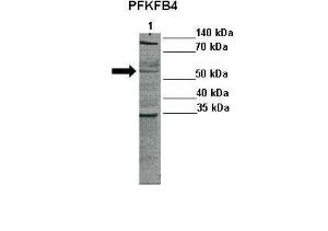 Anti-PFKFB4 Rabbit Polyclonal Antibody