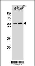 Anti-HOXA10 Rabbit Polyclonal Antibody (Biotin)