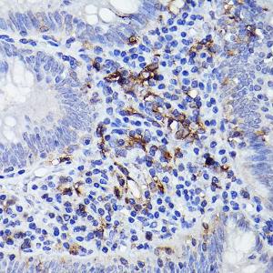 Anti-HLA-DQB1 Rabbit Polyclonal Antibody