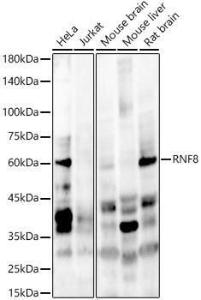 Anti-RNF8 Antibody (A10107)