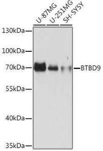 Western blot analysis of extracts of various cell lines, using Anti-BTBD9 Antibody (A308427) at 1:1,000 dilution. The secondary antibody was Goat Anti-Rabbit IgG H&L Antibody (HRP) at 1:10,000 dilution.