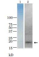 Anti-TRH Toxin Antibody