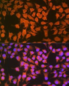 Anti-CBS antibody