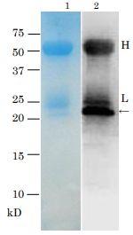 Anti-TRH Toxin Antibody