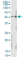 Anti-ESRRA Polyclonal Antibody Pair