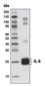 Anti-Interleukin 6 Rabbit Monoclonal Antibody [clone: 13G41]