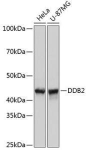 Western blot analysis of extracts of various cell lines, using Anti-DDB2 Antibody [ARC0644] (A80839) at 1:1,000 dilution