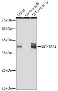 Immunoprecipitation analysis of 300 µg extracts of 293T cells using 3 µg of Anti-SET/TAF-I Antibody [ARC1462] (A305799). This Western blot was performed on the immunoprecipitate using Anti-SET/TAF-I Antibody [ARC1462] (A305799) at a dilution of 1:1000