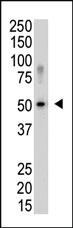 Anti-SENP5 Rabbit Polyclonal Antibody