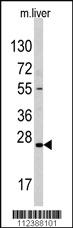 Anti-SOST Rabbit Polyclonal Antibody