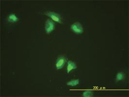 Anti-SLBP Mouse Monoclonal Antibody [clone: 2C4-1C8]