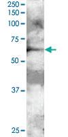 Anti-GRB7 Goat Polyclonal Antibody