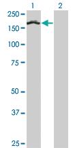 Anti-TCOF1 Mouse Monoclonal Antibody [clone: 8H3]