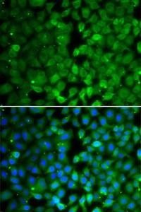 Immunofluorescence analysis of MCF-7 cells using Anti-RUNX3 Antibody (A10108). DAPI was used to stain the cell nuclei (blue)