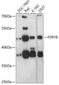 Western blot analysis of extracts of various cell lines, using Anti-P2Y8 Antibody (A308428) at 1:1,000 dilution. The secondary antibody was Goat Anti-Rabbit IgG H&L Antibody (HRP) at 1:10,000 dilution.