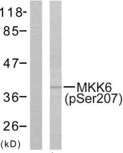 Western blot analysis of lysates from MDA-MB-435 cells using Anti-MKK6 (phospho Ser207) Antibody. The left hand lane represents a negative control, where the Antibody is blocked by the immunising peptide